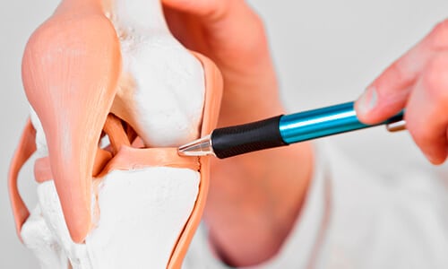 Médico explicando lesión articular de rodilla