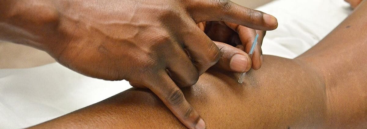 ¿Qué es la punción seca y cómo alivia el dolor?