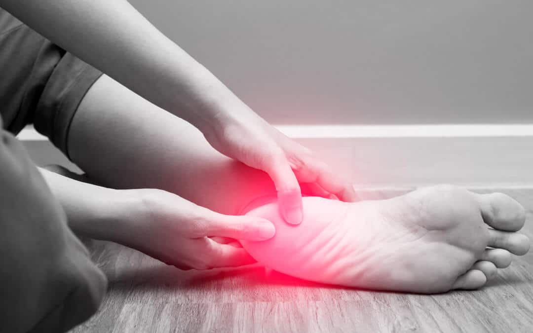 Fascitis plantar
